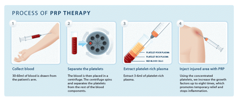 PRP Platelet Rich Plasma infographic